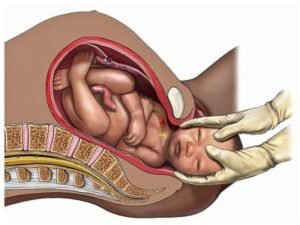 Painless Normal Vaginal Delivery in Pune with safe pregnancy care guidance by Dr. Pallavi Tekale Deshpande